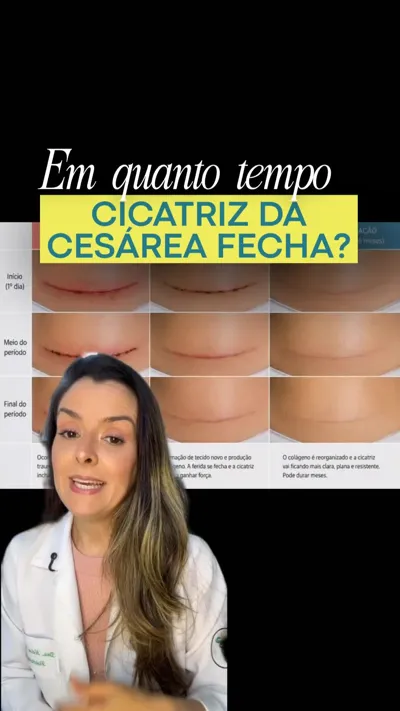 Reel Você olha para a sua cicatriz